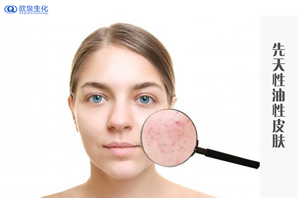 不同肤质需要不同的护肤方法-欧泉生化